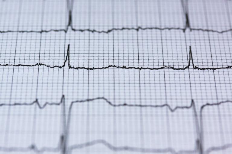 Cardiovascular